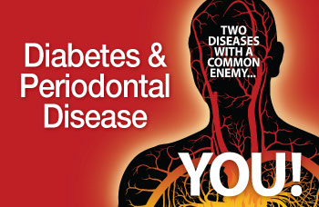 diabetes-and-periodontal-disease-350.jpg